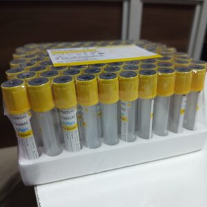 Gel&Clot Activator Tube(Yellow Tops)