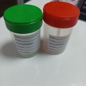 Urine Container 60ml